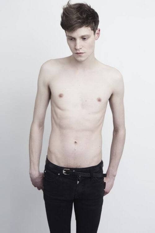 Skinny body to weight gain